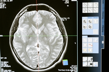 Neurology Specialization for Healthcare Professionals 